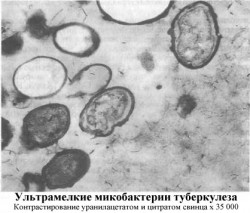 Ультрамелкие микобактерии туберкулеза